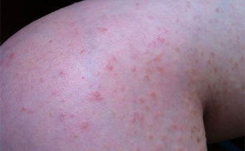 ʪ����ô����� ����ʪ�����ķ���